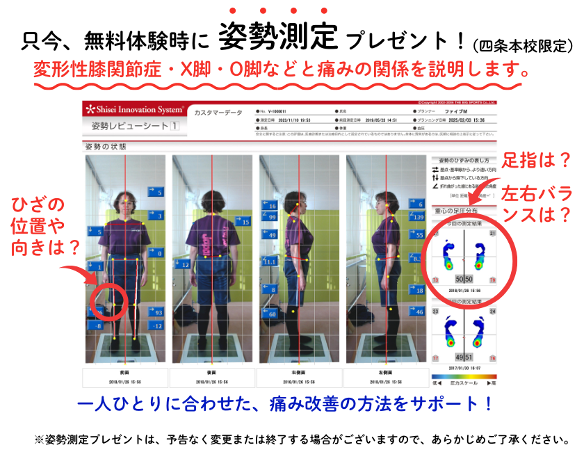 ひざ痛改善の姿勢測定プレゼント